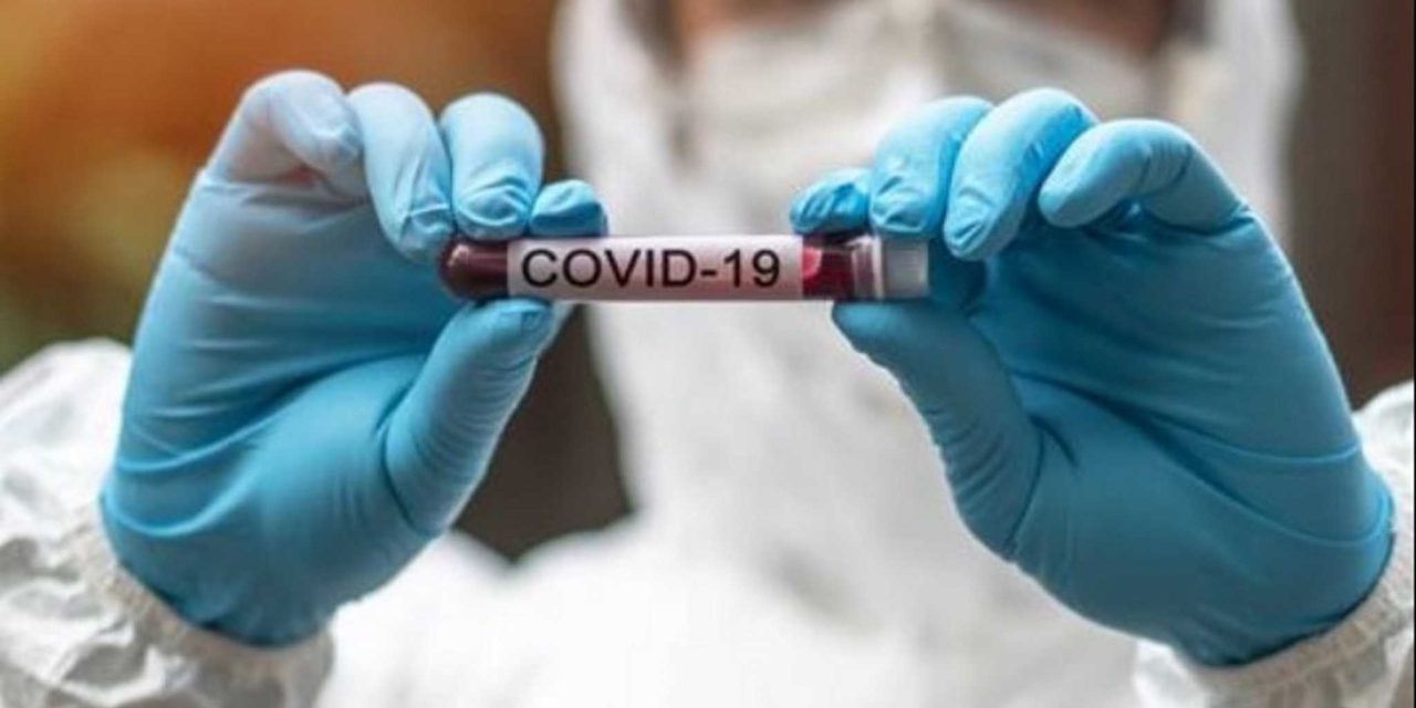 COVID-19 Severity Influences Preventive Measures More than Fear of Getting It