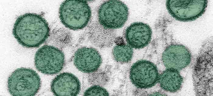 Deadly Cruise Virus Crisis Deepens as Fourth Passenger Falls ill
